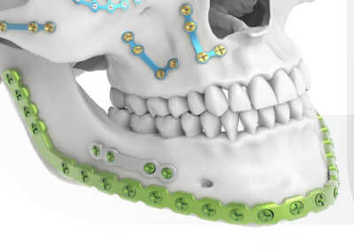 Mandíbula Trauma